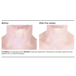 PCA SKIN Perfecting Neck & Decollete