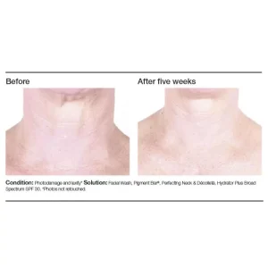 PCA SKIN Perfecting Neck & Decollete