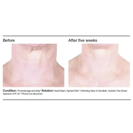 PCA SKIN Perfecting Neck & Decollete