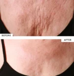 SilcSkin Decollette Pad - Image 2