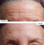 SilcSkin Brow Pads - Image 2