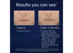PCA Skin BPO 5% Cleanser - Image 8