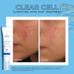 IMAGE Skincare CLEAR CELL clarifying acne spot treatment - Image 9