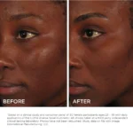 IMAGE Skincare ILUMA intense facial illuminator - Image 9