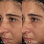 IMAGE Skincare ORMEDIC balancing biopeptide crème - Image 6