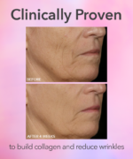 Dr. Dennis Gross DRx SpectraLite™ FaceWare Pro 3-Minute LED Device - Image 6