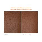 Dr. Dennis Gross Alpha Beta® Exfoliating Body Treatment - Image 5