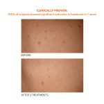 Dr. Dennis Gross Alpha Beta® Exfoliating Body Treatment - Image 7