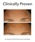 Dr. Dennis Gross Alpha Beta&reg; Extra Strength Daily Peel - Image 10