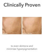 Dr. Dennis Gross Alpha Beta&reg; Extra Strength Daily Peel - Image 8