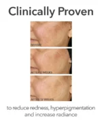 Dr. Dennis Gross Alpha Beta&reg; Universal Daily Peel - Image 7