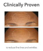 Dr. Dennis Gross Alpha Beta® Extra Strength Daily Peel - Image 4