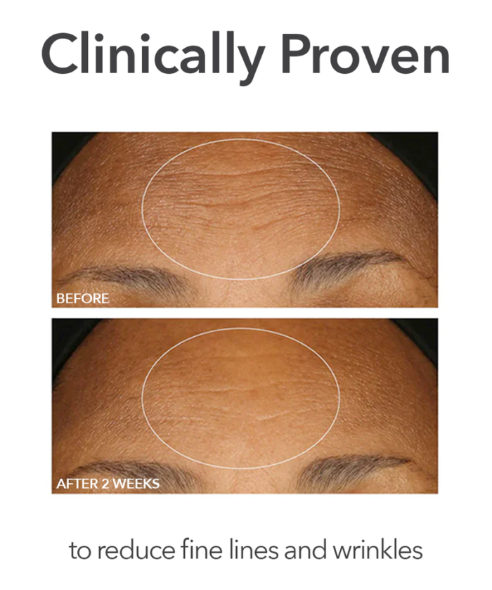 Dr. Dennis Gross Alpha Beta® Extra Strength Daily Peel - Image 4