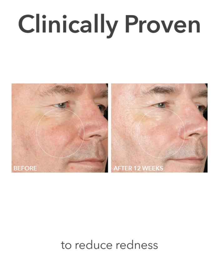 Dr. Dennis Gross Alpha Beta® Extra Strength Daily Peel - Image 6