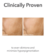 Dr. Dennis Gross Alpha Beta® Extra Strength Daily Peel - Image 7