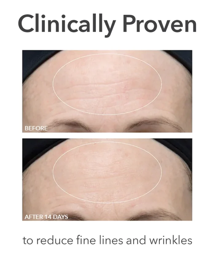Dr. Dennis Gross Alpha Beta® Ultra Gentle Daily Peel - Image 5