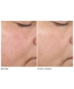 Dr. Dennis Gross Advanced Retinol + Ferulic Texture Renewal Serum - Image 5