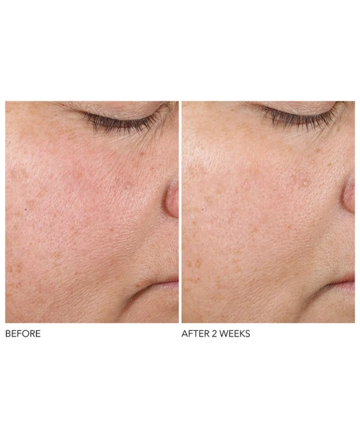 Dr. Dennis Gross Advanced Retinol + Ferulic Texture Renewal Serum - Image 5