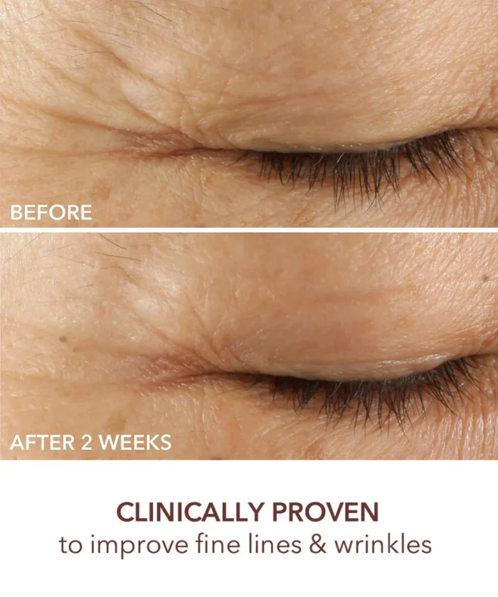 Dr. Dennis Gross Advanced Retinol + Ferulic Triple Correction Eye Serum - Image 6