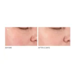 Dr. Dennis Gross Alpha Beta® Pore Perfecting & Refining Serum - Image 3