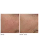 Dr. Dennis Gross Advanced Retinol + Ferulic Overnight Wrinkle Treatment - Image 5