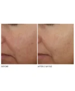 Dr. Dennis Gross Advanced Retinol + Ferulic Overnight Wrinkle Treatment - Image 7