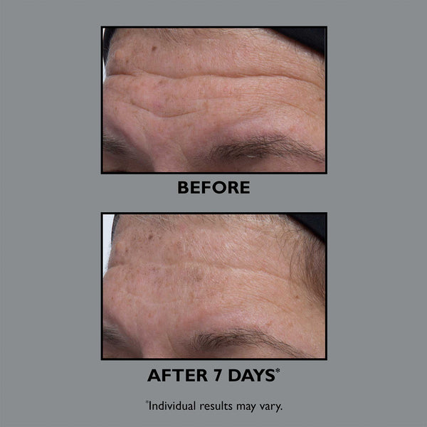 15-01-246-2 Peter Thomas Roth FIRMx Collagen Serum - Image 2