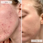 Omnilux CLEAR - Image 11