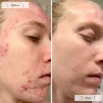 Omnilux CLEAR - Image 12