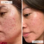 Omnilux CLEAR - Image 13