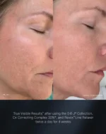 Revision Revox™ Line Relaxer 1.00 fl oz - Image 5