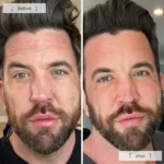 Omnilux Men - Image 9