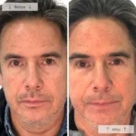 Omnilux Men - Image 11