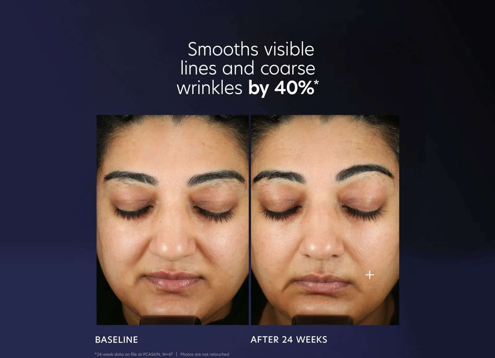 Pro-maxbeforeandafter1copy2_91da9340-5547-4f76-a5bd-fb8c7edcc5b3 PCA SKIN Pro-Max Age Renewal - Image 4