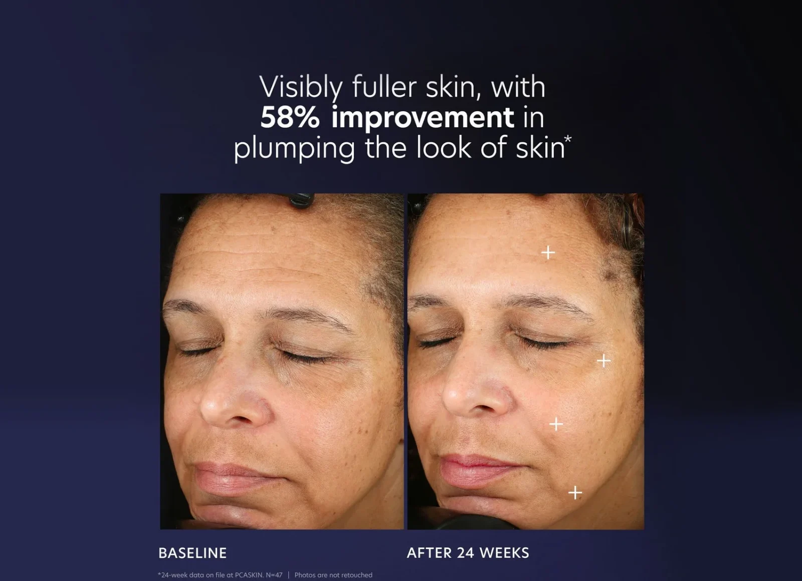 Pro-maxbeforeandafter1copy_9c666242-4b2a-435a-8188-d8dd6ad36448 PCA SKIN Pro-Max Age Renewal - Image 5