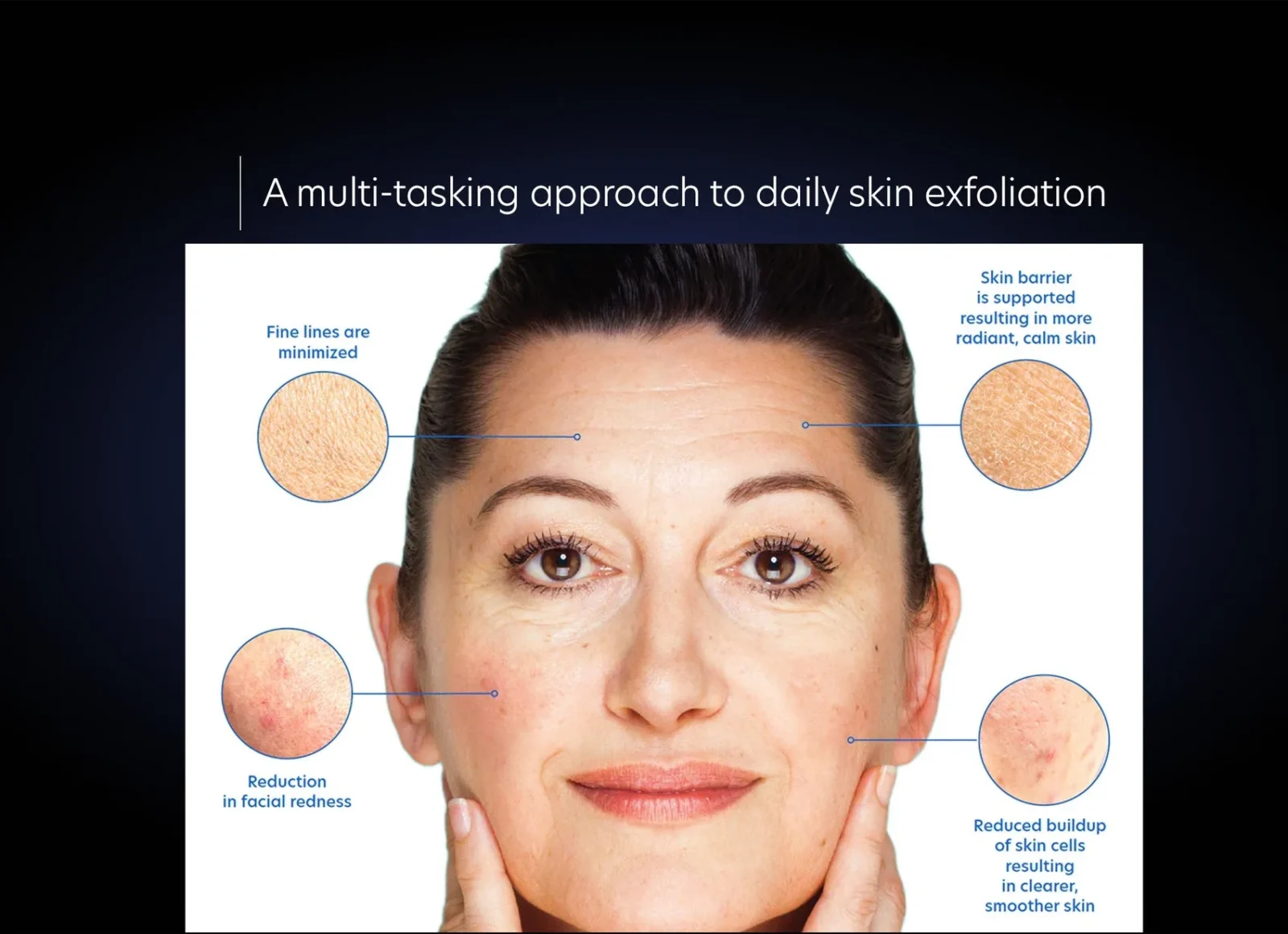 ResurfacingSerumAMulti-taskingapproach PCA SKIN Resurfacing Serum - Image 3