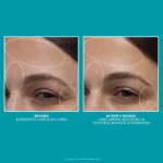 Peter Thomas Roth Peptide Skinjection Moisture Infusion Cream - Image 9