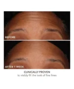 Dr. Dennis Gross DermInfusions™ Fill + Repair Serum with Hyaluronic Acid - Image 7