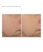 Dr. Dennis Gross Vitamin C Lactic Oil-Free Radiant Moisturizer - Image 9