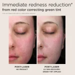 EltaMD UV Skin Recovery Red Color Correcting Green Tint Broad Spectrum SPF 50 - Image 6