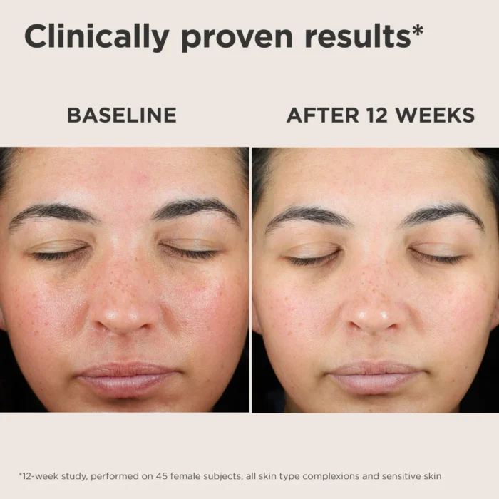 EltaMD UV Skin Recovery Red Color Correcting Green Tint Broad Spectrum SPF 50 - Image 7
