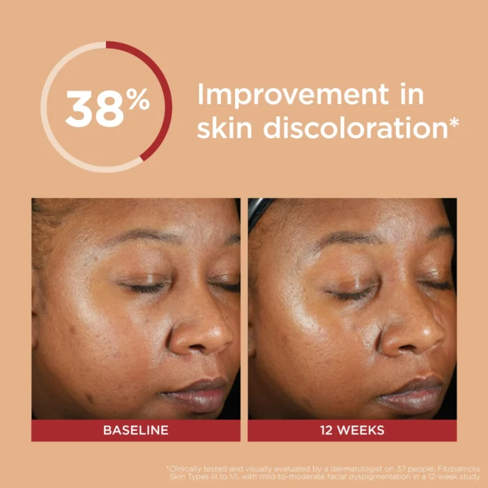 EltaMD UV Clear Deep Tinted Broad-Spectrum SPF 46 - Image 7