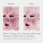 EltaMD Skin Recovery Amino Acid Foaming Cleanser - Image 7