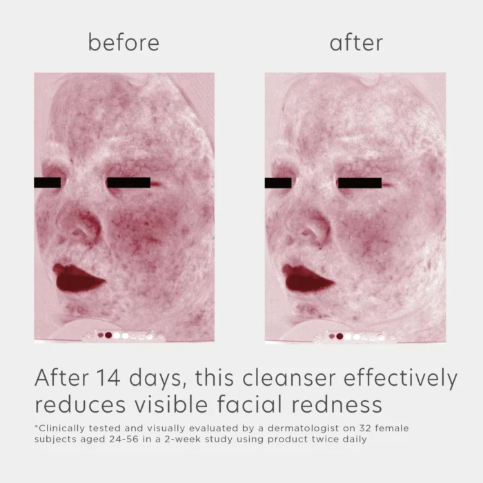 EltaMD Skin Recovery Amino Acid Foaming Cleanser - Image 3