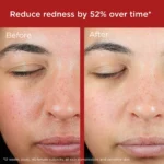 EltaMD UV Skin Recovery Red Color Correcting Green Tint Broad Spectrum SPF 50 - Image 9