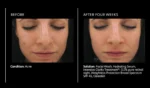 PCA SKIN Intensive Clarity Treatment®: 0.5% pure retinol & salicylic acid - Image 4