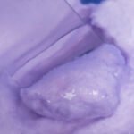 Troiareuke ACSEN Purple Cica Mask (5 Sheets) - Image 5