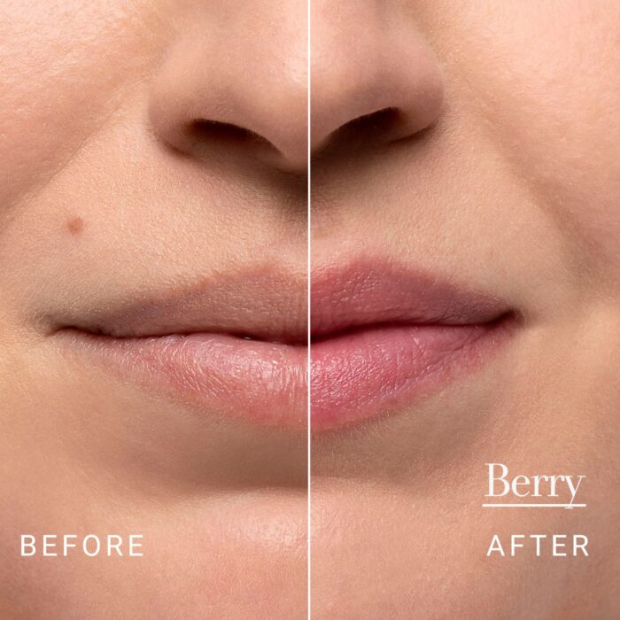 Fresh Sugar Lip Treatment - Berry Tinted - Image 6