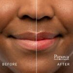 Fresh Sugar Lip Treatment - Papaya Tinted - Image 6