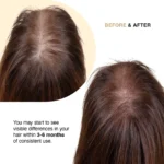 Capillus Hair Supplement - Image 3
